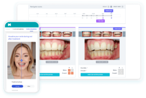 DentalMonitoring-AI-Solution-for-Dentists