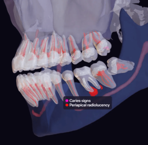 Diagnocat-AI-Powered-Dental-Software