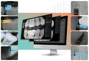 Pearls-Second-Opinion-AI-Powered-Dental-Software