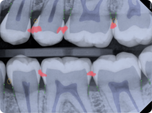 VideaHealth-AI-for-Dentistry
