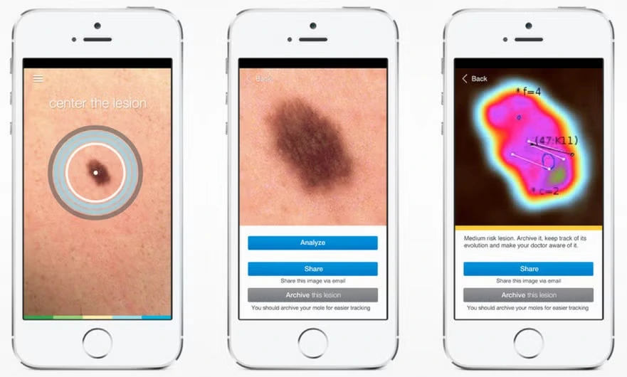 Skinvision App Features
